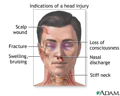 Indications of head injury