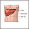 Liver transplant - series