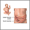 Intestinal obstruction (Pediatric) - series