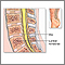 Bone graft - series