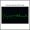 Atrioventricular block, ECG tracing