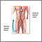 Venous thrombosis - series