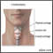 Emergency airway puncture