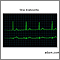 Bradycardia