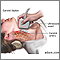 Carotid duplex