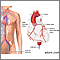 Coronary angiography