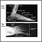 Normal foot X-ray