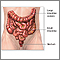 Colostomy  - series