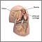 Chondromalacia of the patella