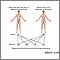 Autosomal dominant genes