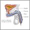 Catheterization