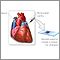 Pericardial fluid stain