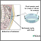 Peritoneal culture