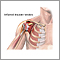 Inflamed shoulder tendons