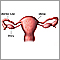 Uterine anatomy