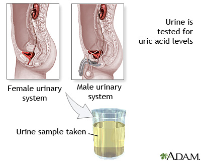 Uric acid test