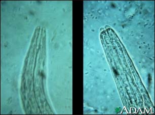 Hookworm - mouth of the organism