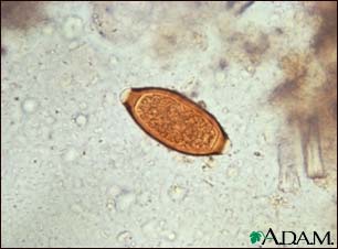 Trichuris trichiura egg