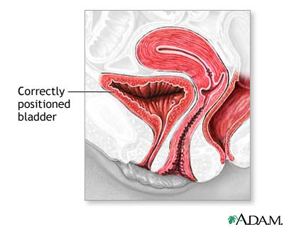 Procedure