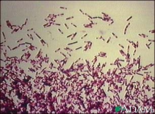 Clostridium difficile organism