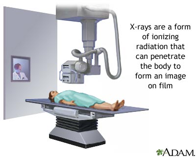 X-ray