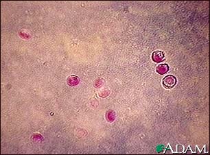 Cryptosporidium, organism