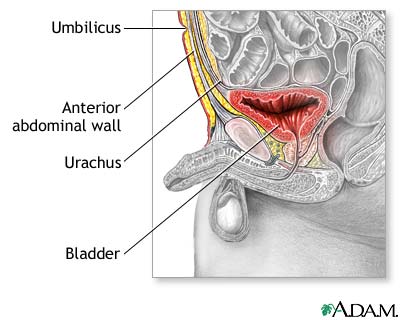 Normal anatomy