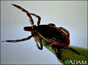 Tick, deer - adult female