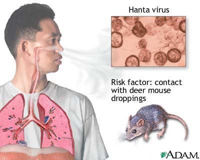 Hanta virus