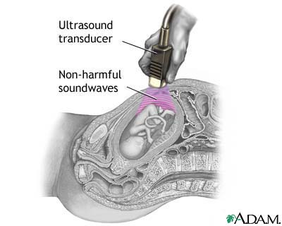 Ultrasound