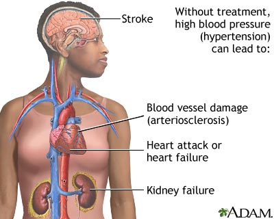 Untreated hypertension