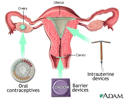 Birth control methods