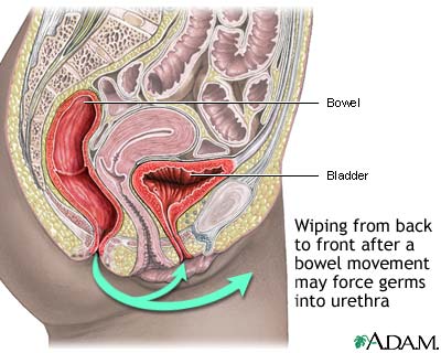 Prevention of cystitis