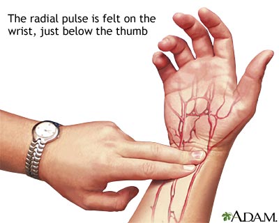 Radial pulse