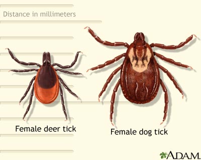 Deer and dog&#160;tick