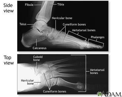 Normal foot X-ray