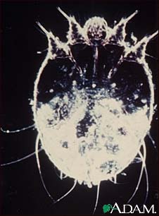 Scabies mite, photomicrograph