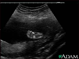 Ultrasound, normal fetus - foot