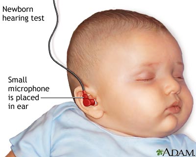 Hearing test