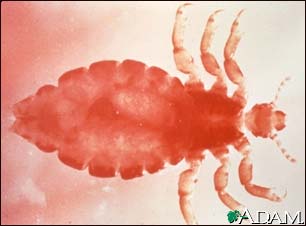 Head louse - female