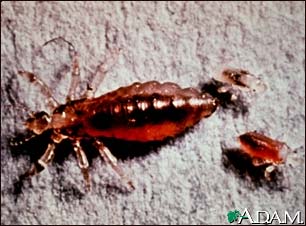 Body louse, female and larvae