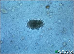 Hookworm egg