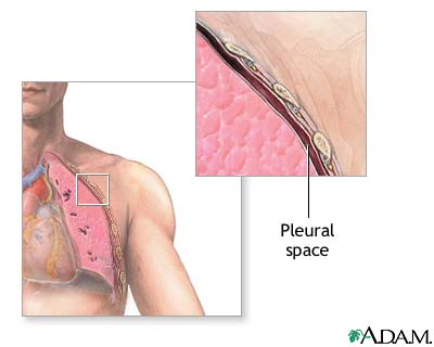 Normal anatomy