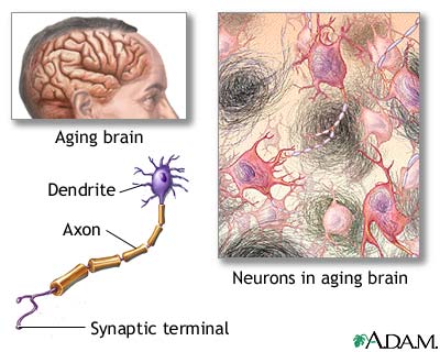 Aged nervous tissue