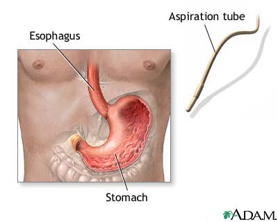 Stomach acid test