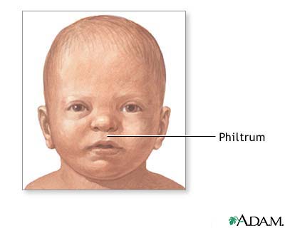 Philtrum