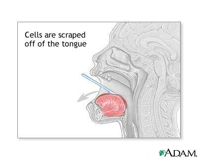 Buccal smear