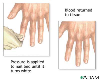 Nail blanch test