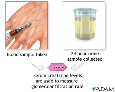 Creatinine tests