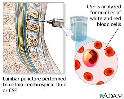 CSF cell count